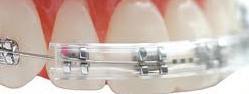 Morgan Bumper - Brace Guard